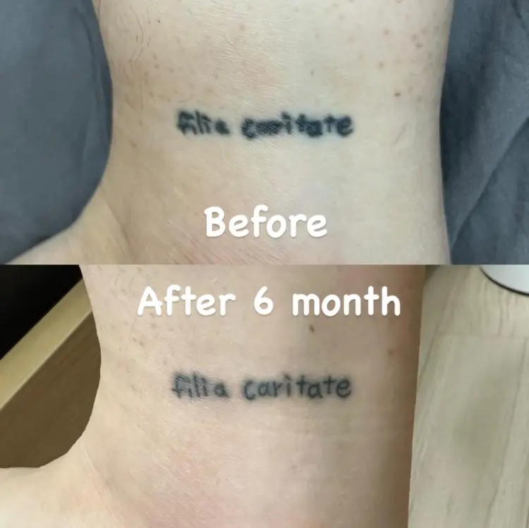 tattooist_arar
