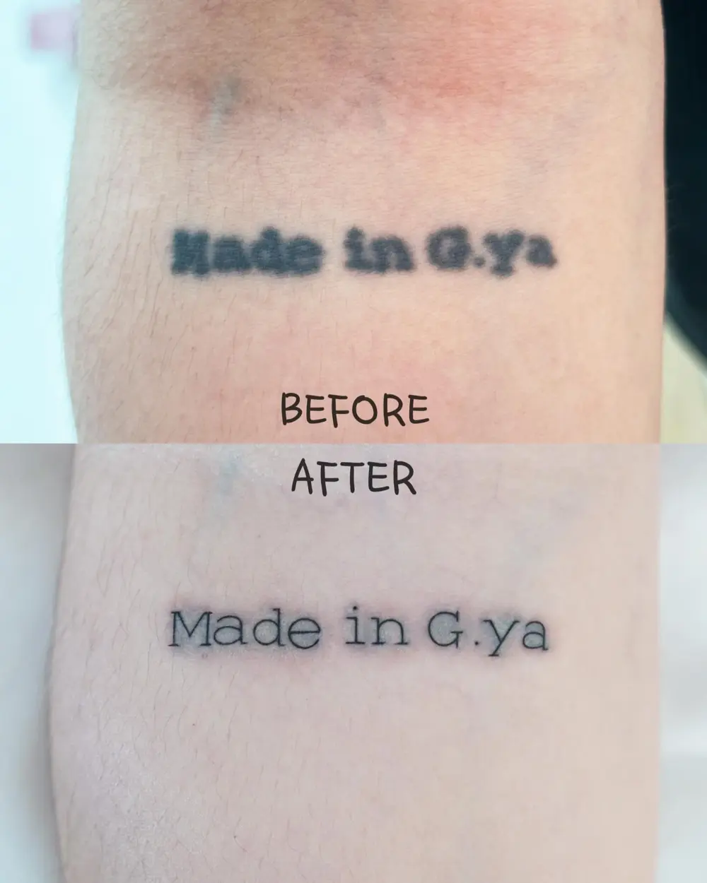 tattooist_arar