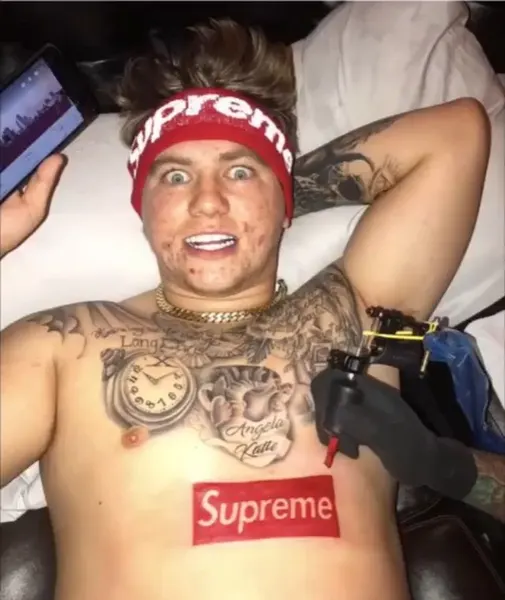 romeolacoste