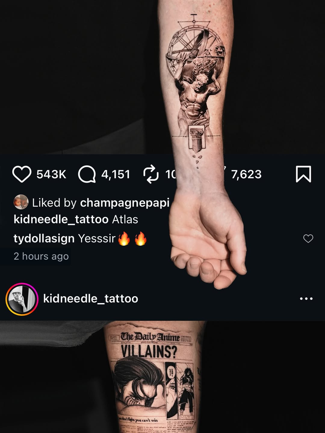 kidneedle_tattoo