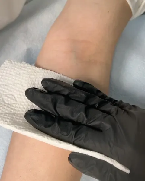 Mini, 토끼