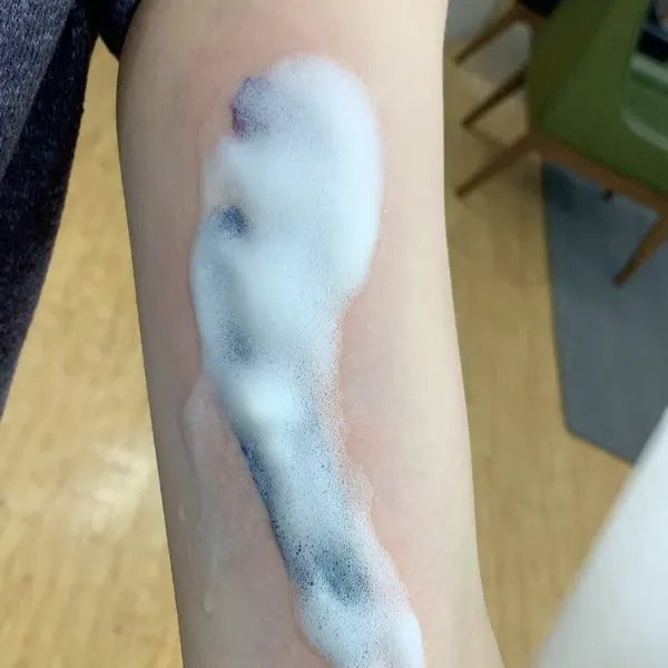 조개