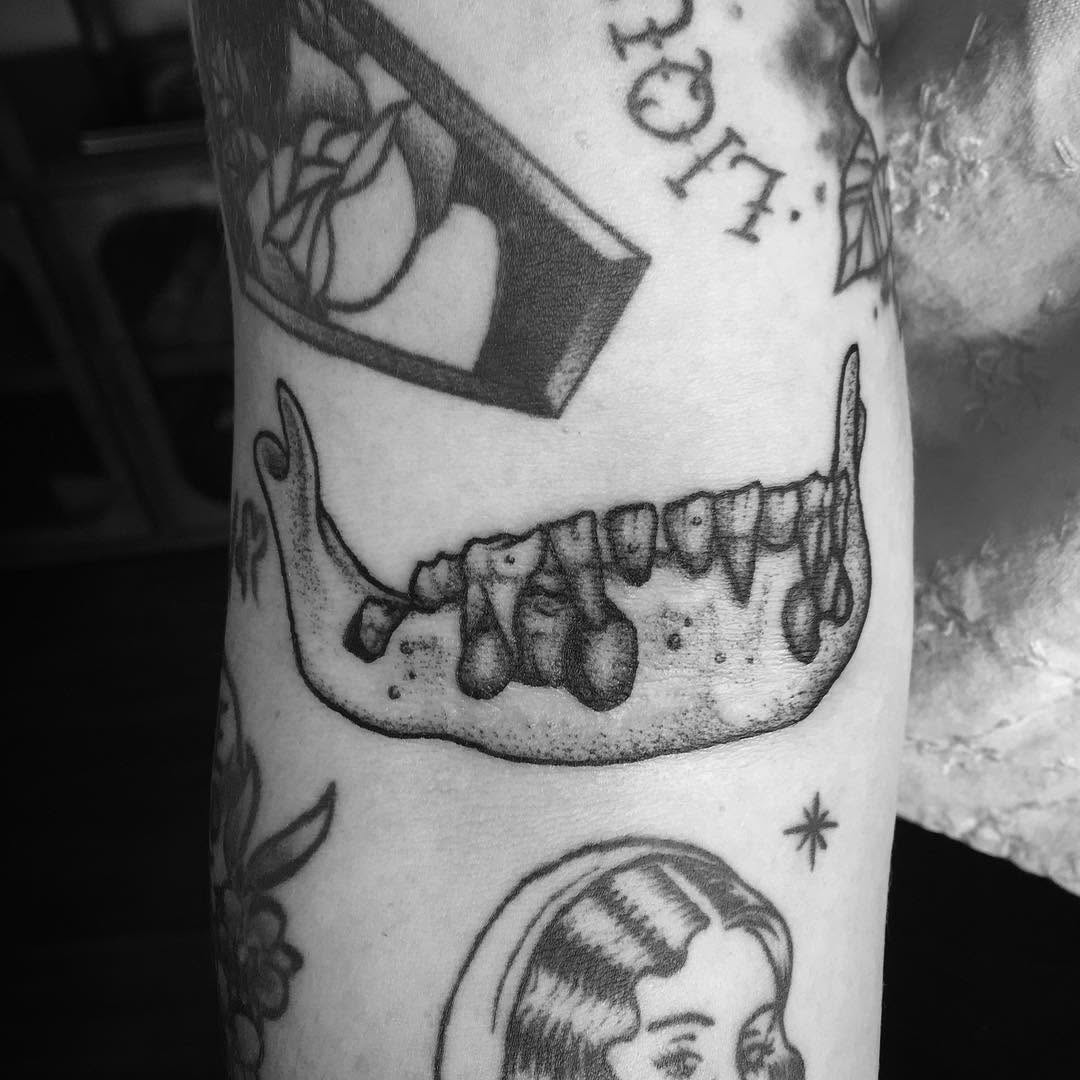 vitrioltattoo