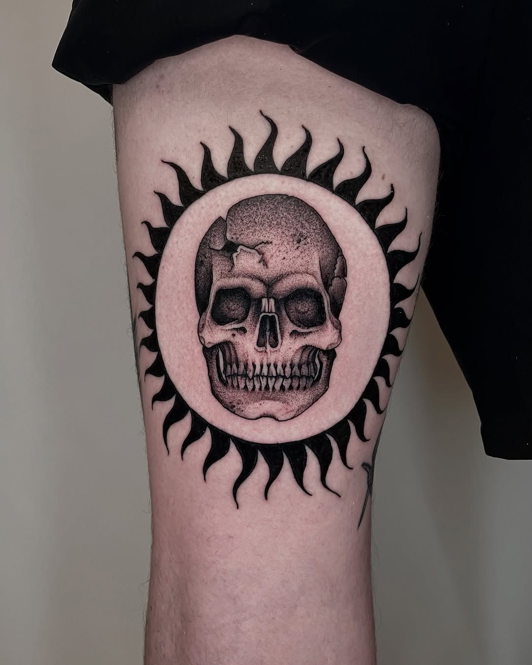 Skull